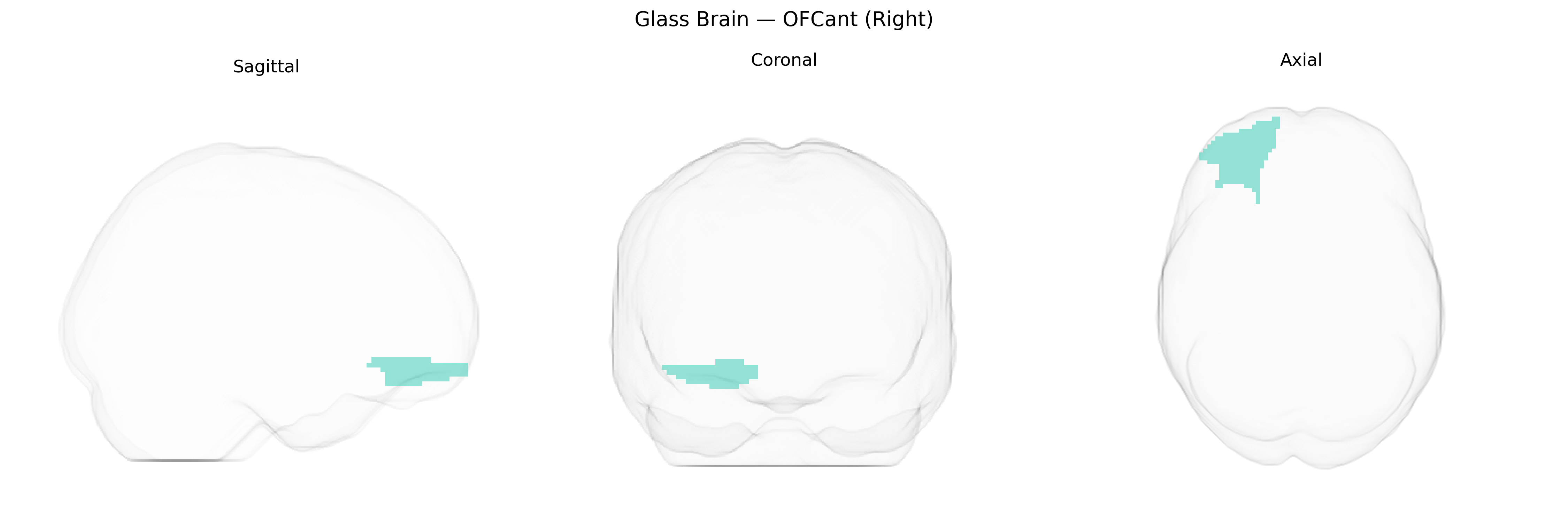 Triplanar Ghost Brain
