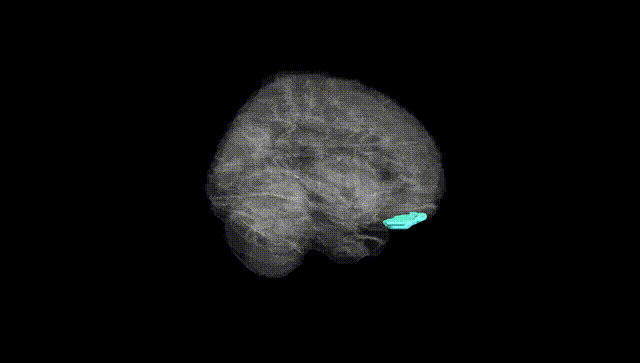 Full Brain Black