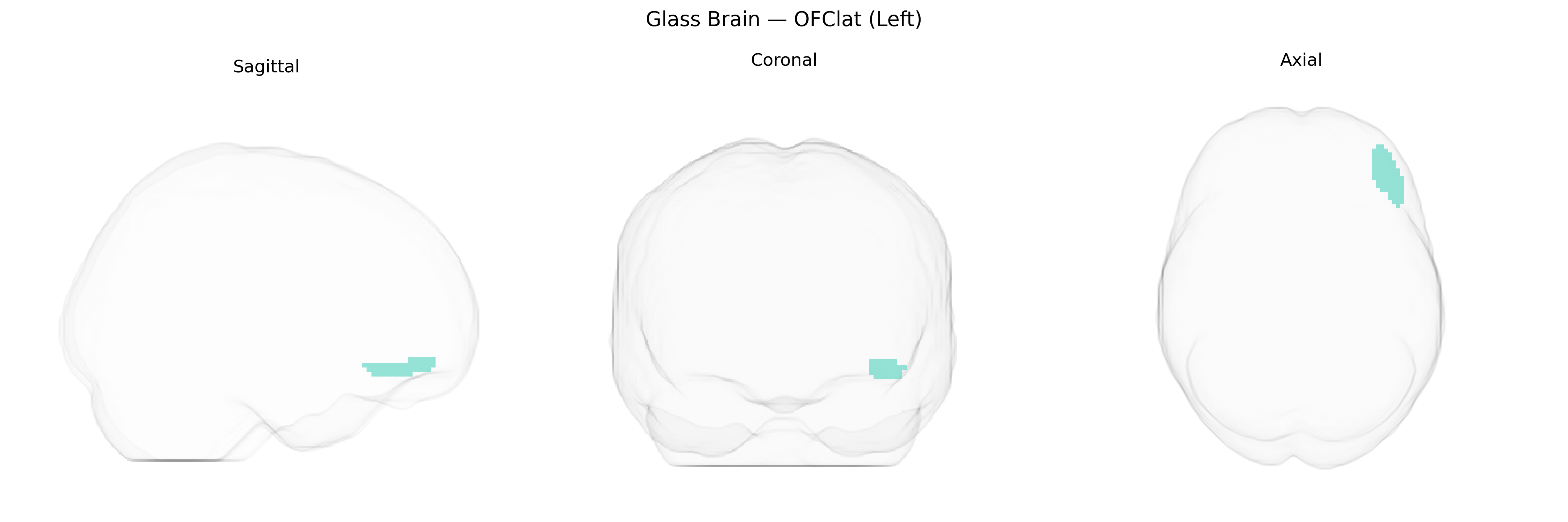 Triplanar Ghost Brain