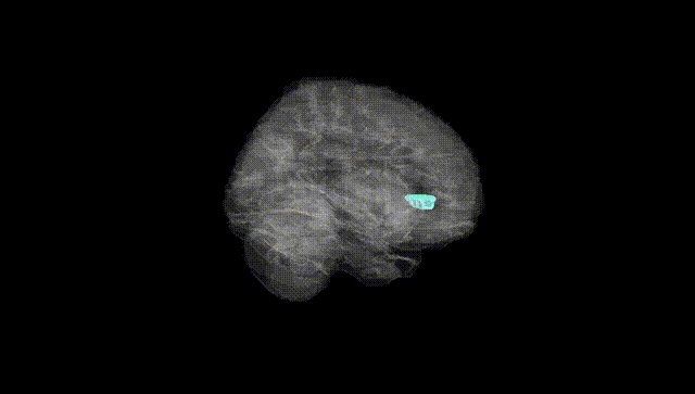 Full Brain Black