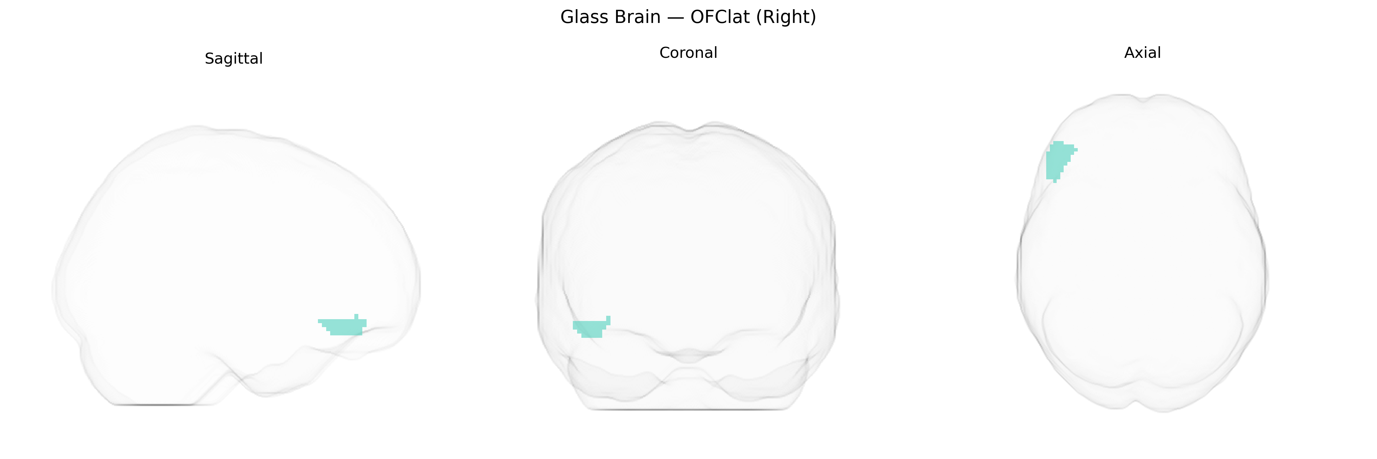 Triplanar Ghost Brain