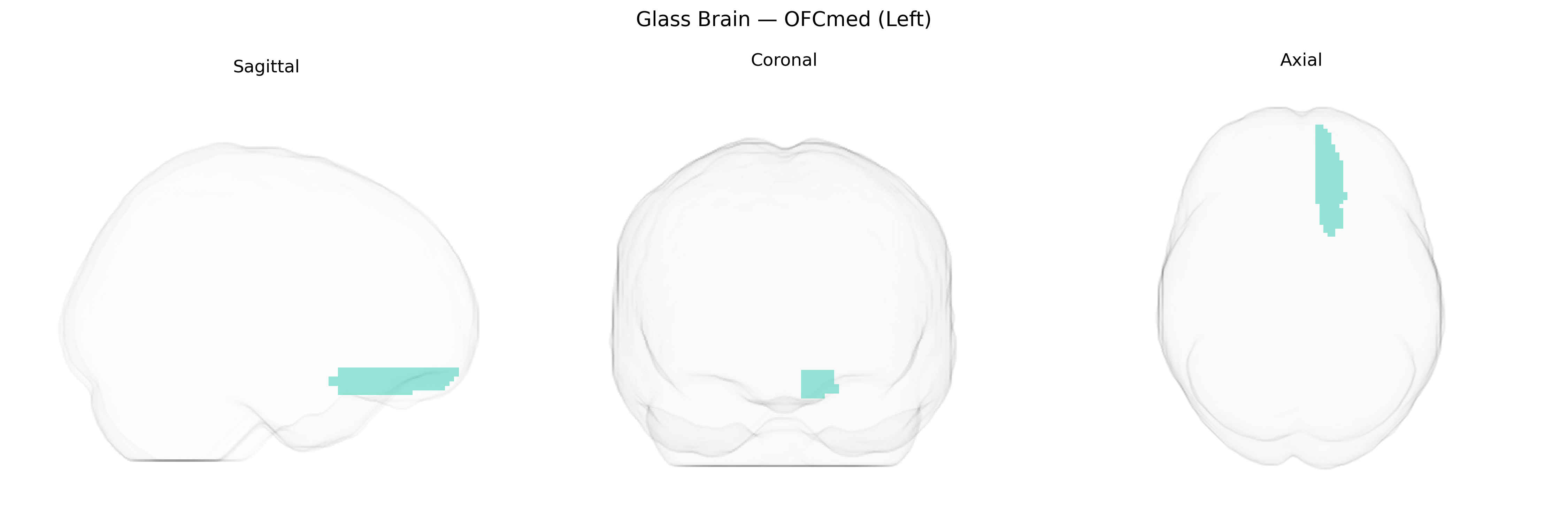 Triplanar Ghost Brain