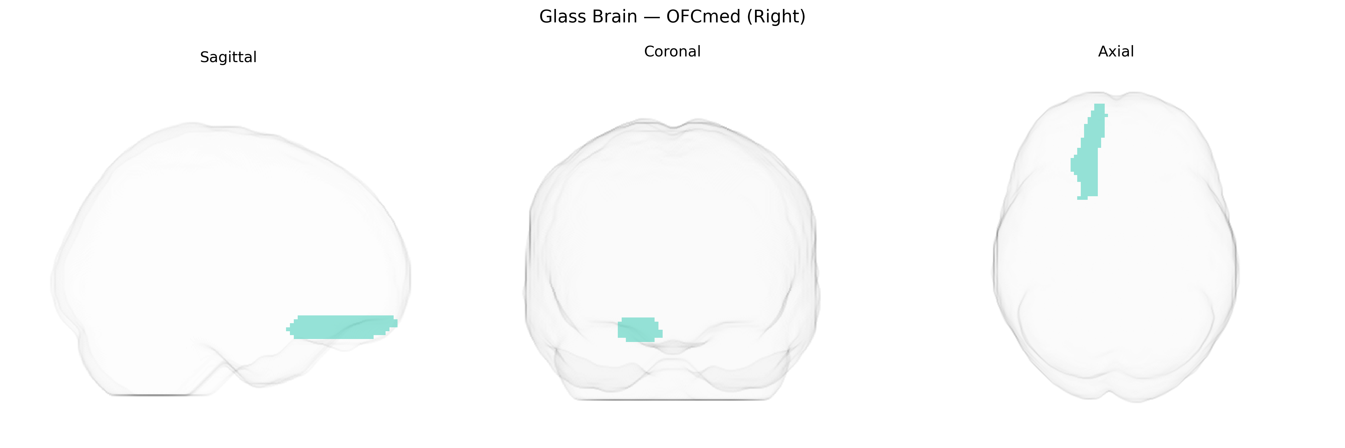 Triplanar Ghost Brain