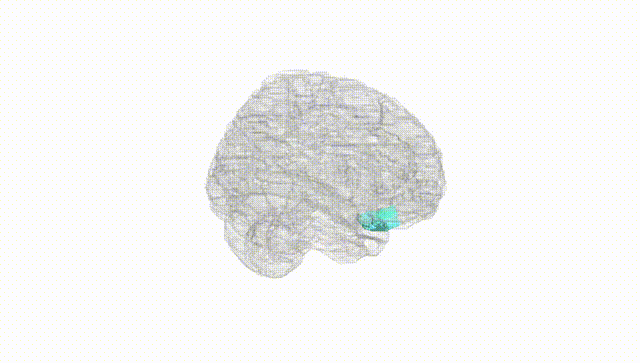 Full Brain White
