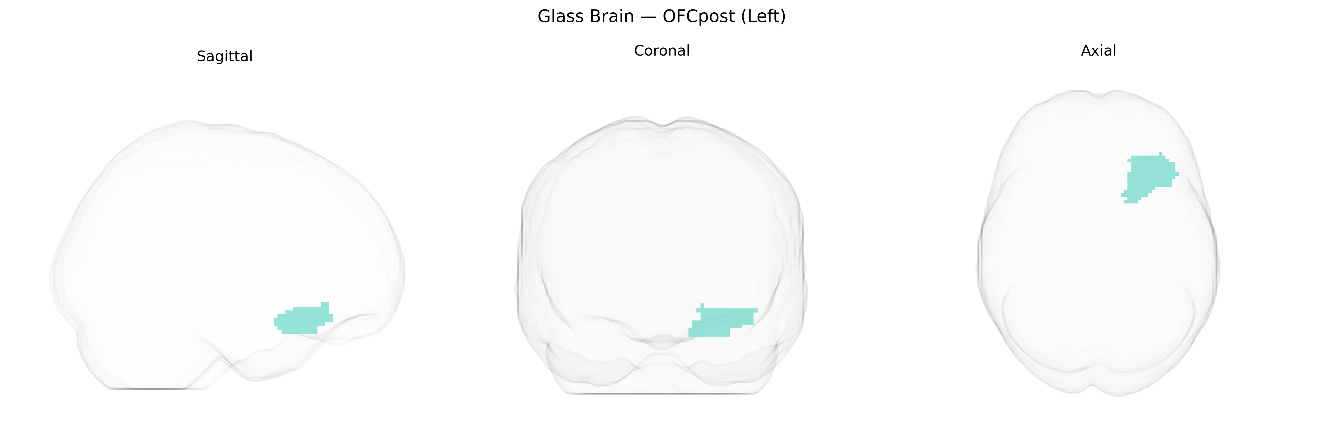 Triplanar Ghost Brain