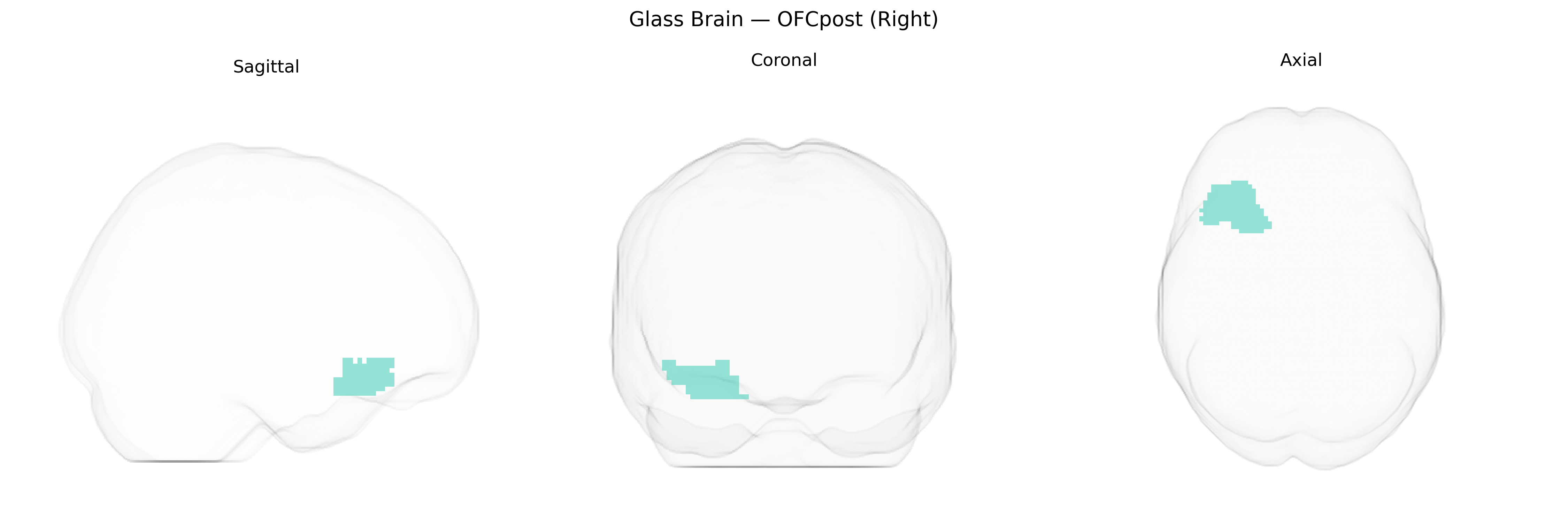 Triplanar Ghost Brain