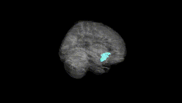 Full Brain Black