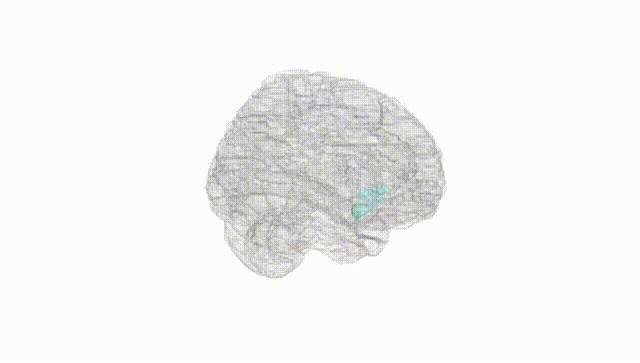Full Brain White