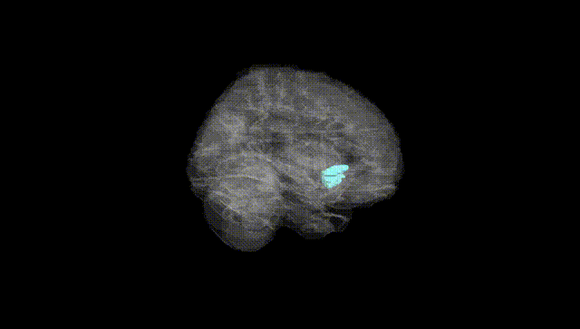 Full Brain Black