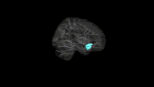 Hemisphere Black