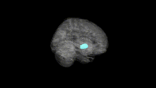 Full Brain Black