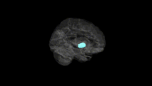 Hemisphere Black