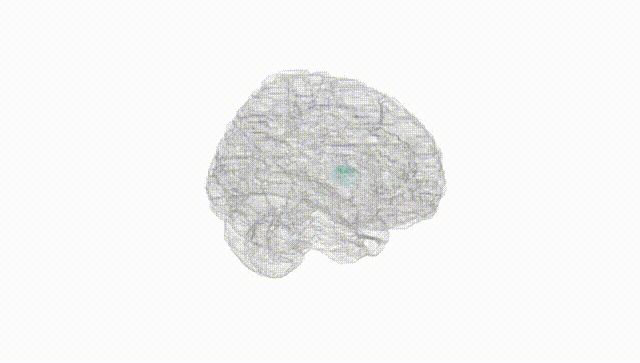Full Brain White