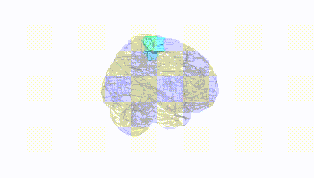 Full Brain White
