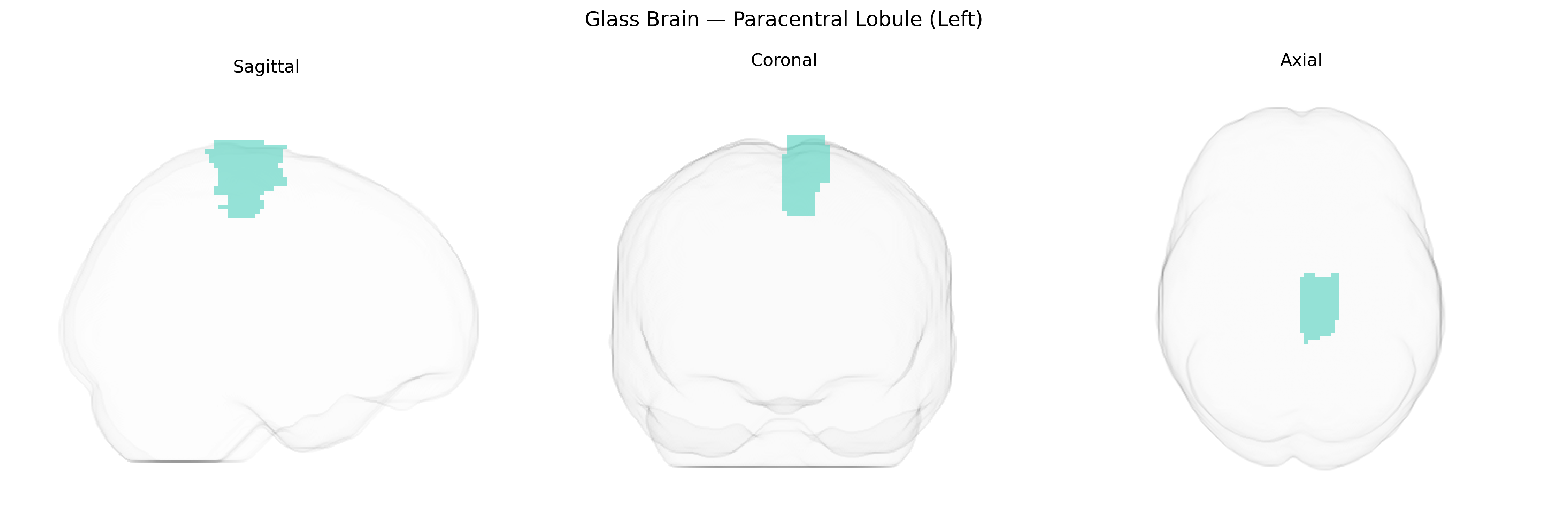 Triplanar Ghost Brain