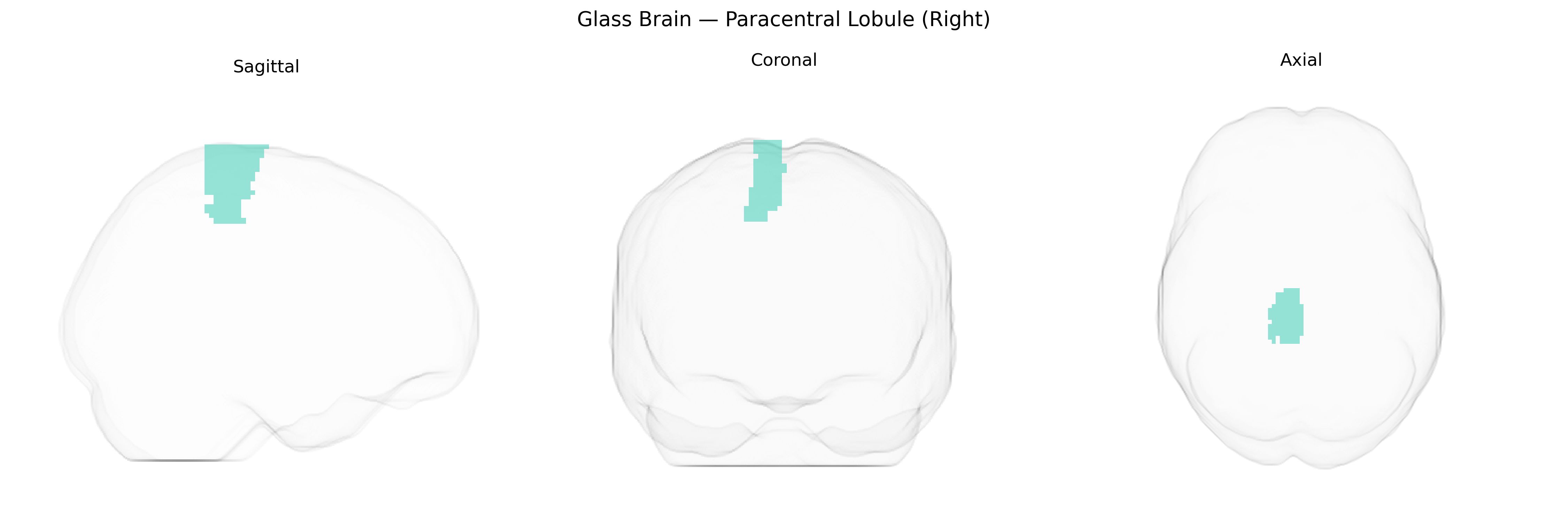 Triplanar Ghost Brain