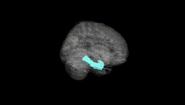 Full Brain Black