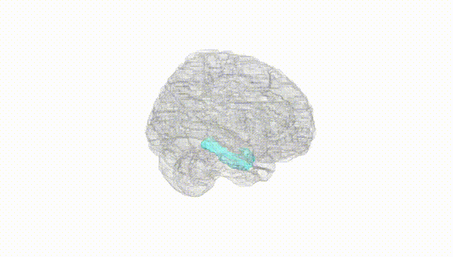 Full Brain White