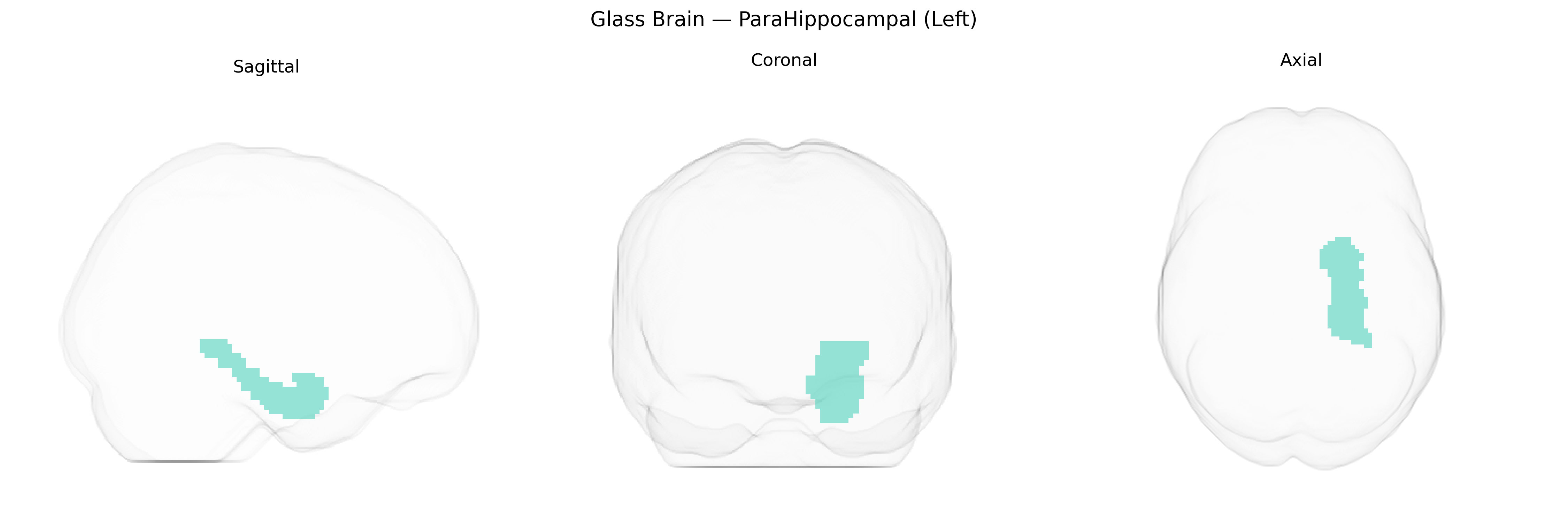 Triplanar Ghost Brain