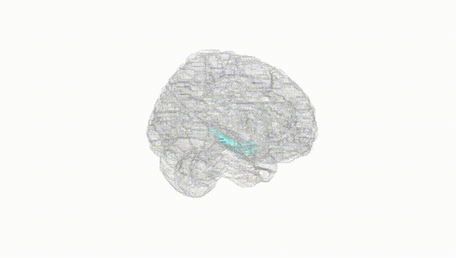 Full Brain White