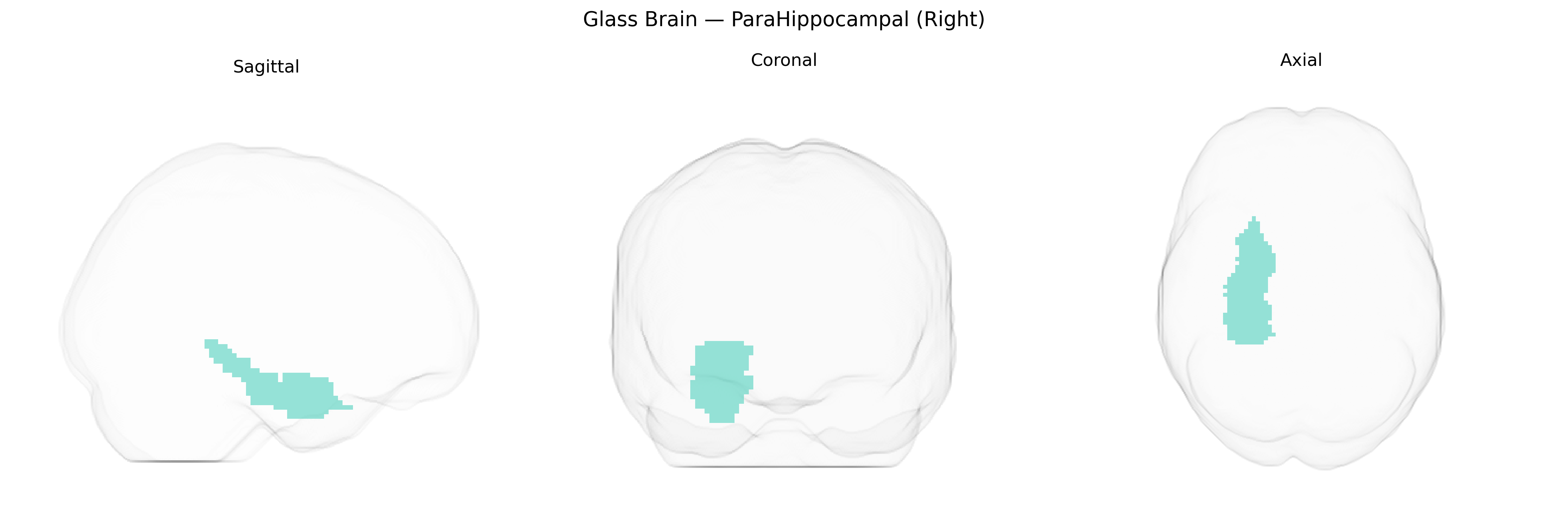 Triplanar Ghost Brain