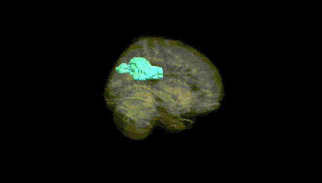 Full Brain Black