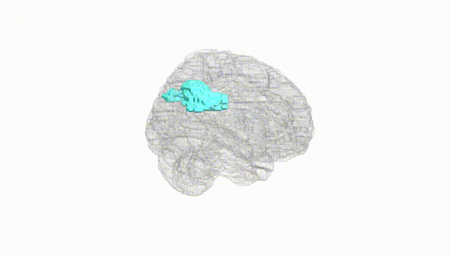 Full Brain White