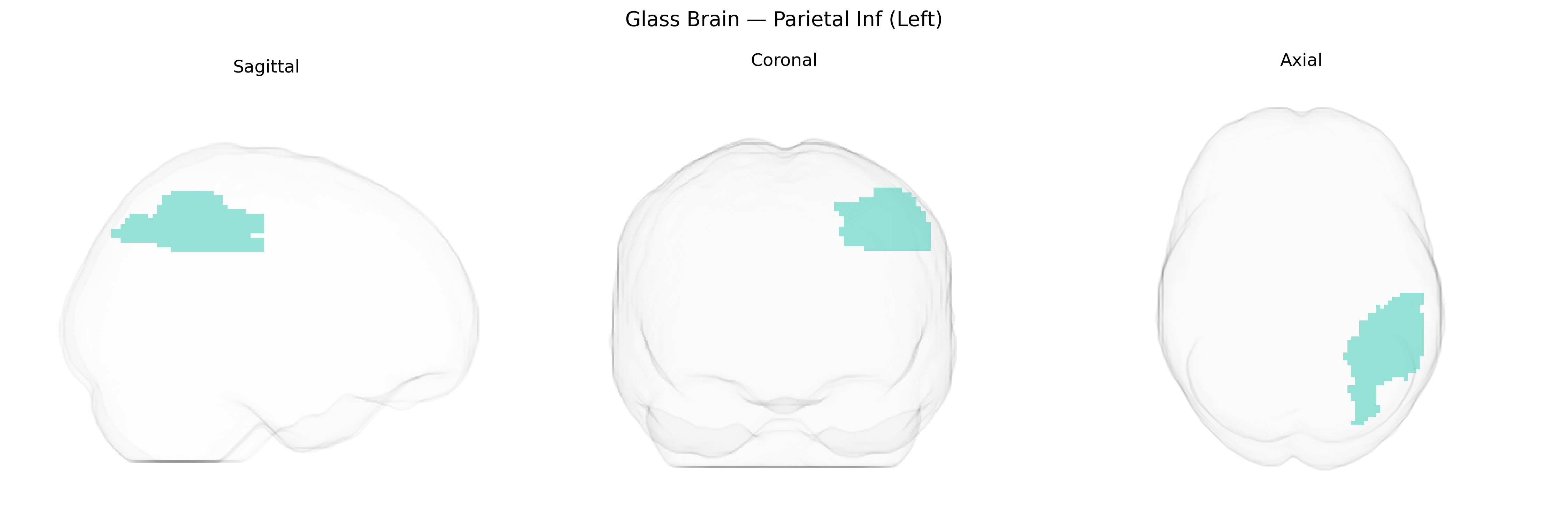 Triplanar Ghost Brain