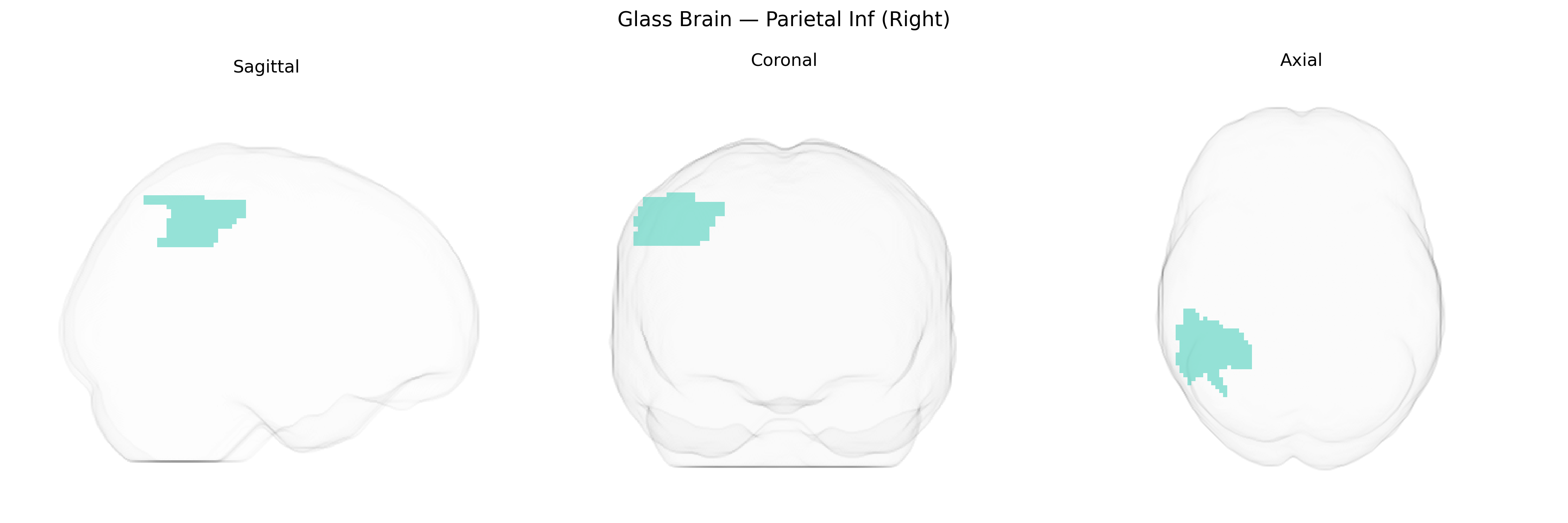 Triplanar Ghost Brain