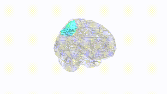 Full Brain White