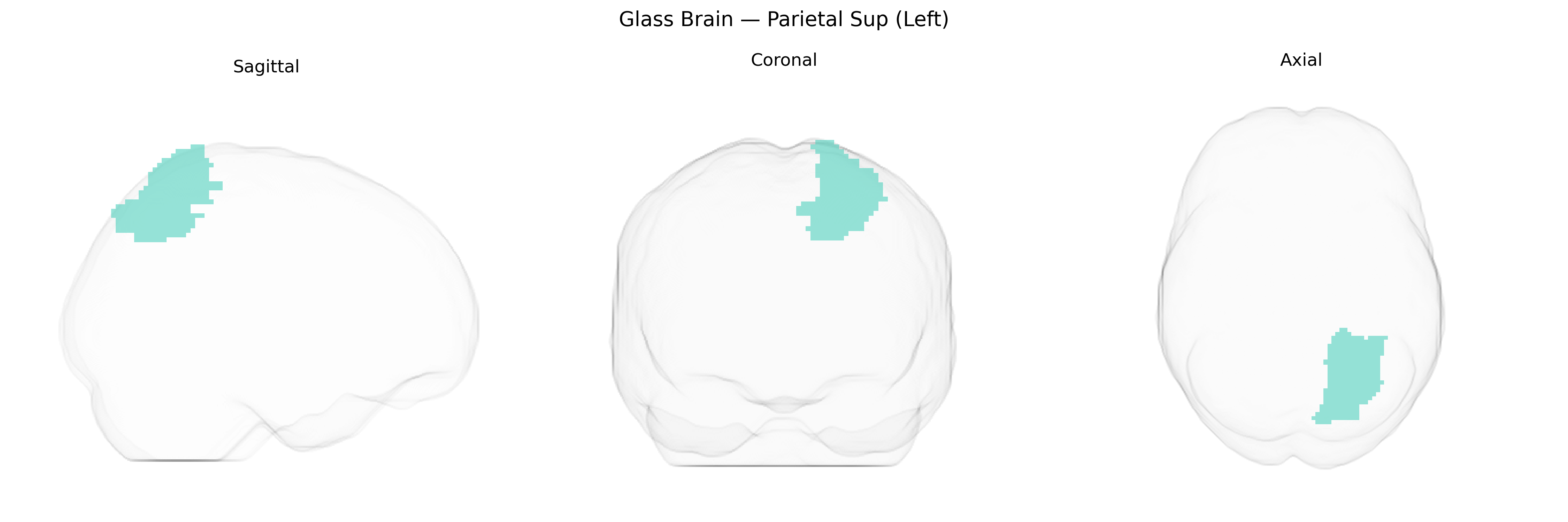 Triplanar Ghost Brain