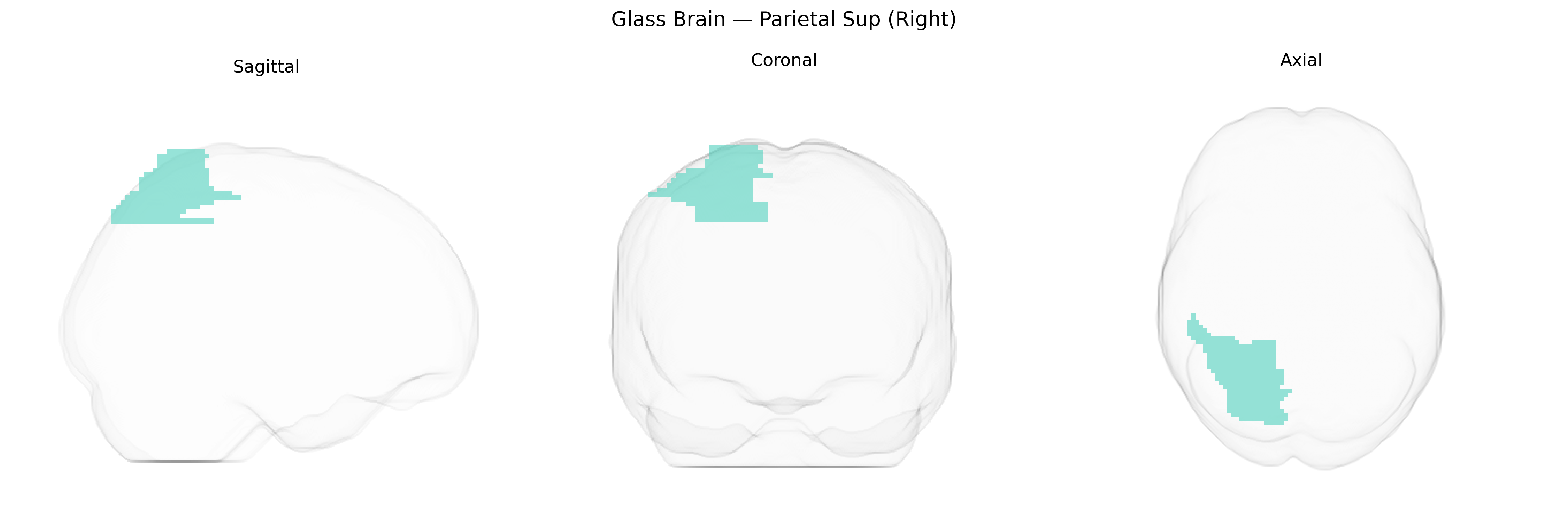 Triplanar Ghost Brain