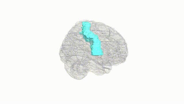 Full Brain White