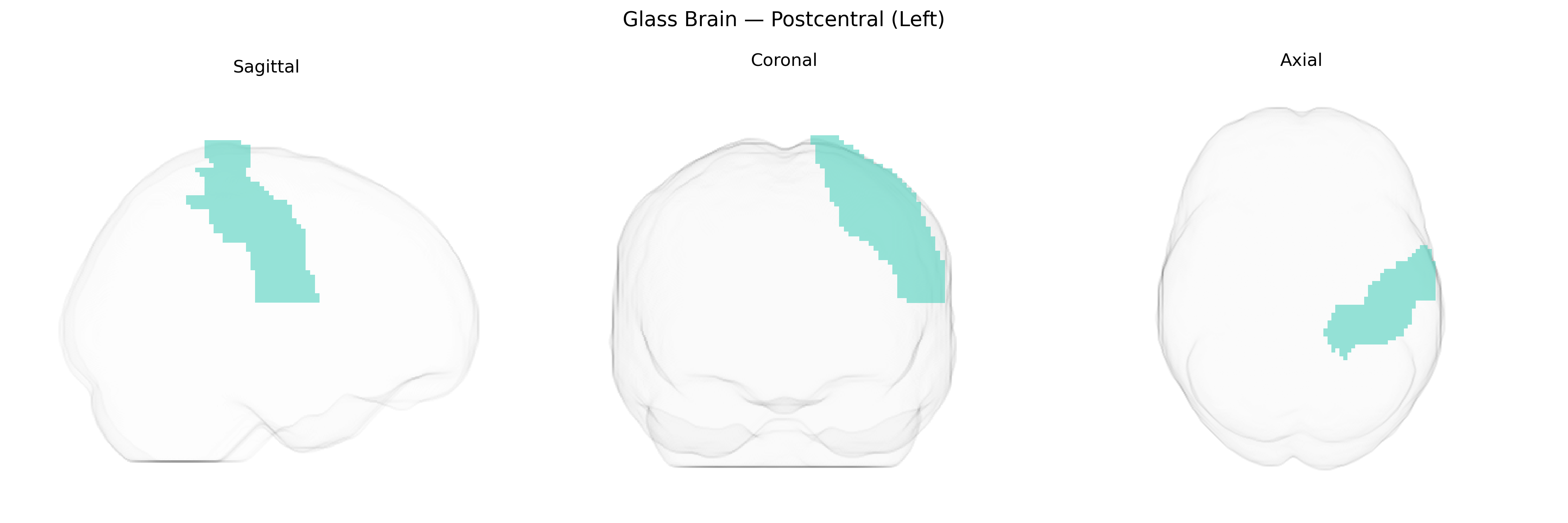 Triplanar Ghost Brain