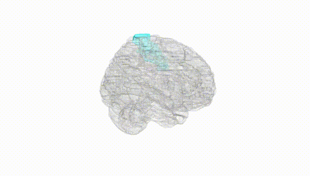 Full Brain White