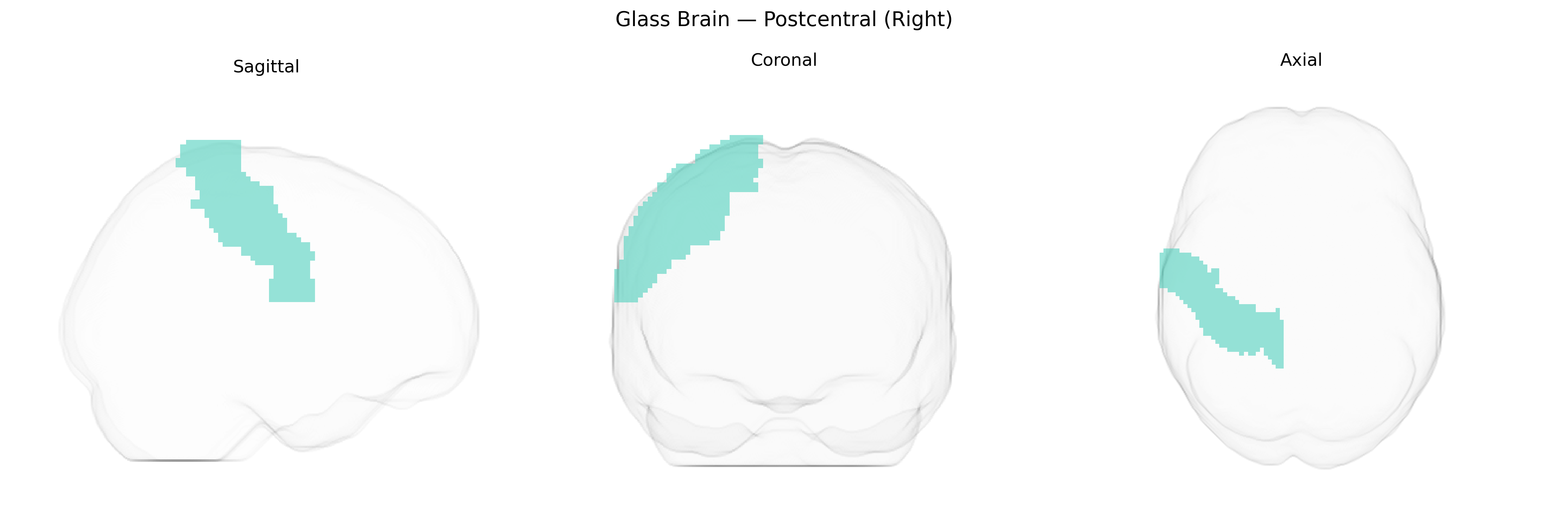 Triplanar Ghost Brain