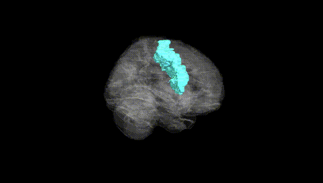 Full Brain Black