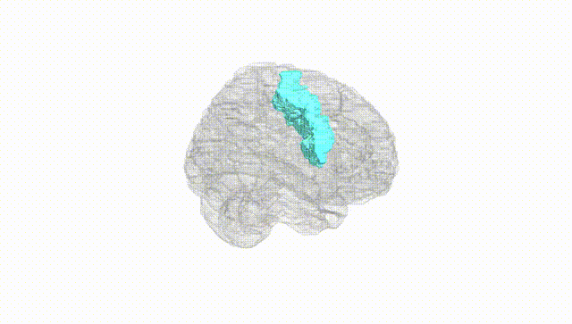 Full Brain White