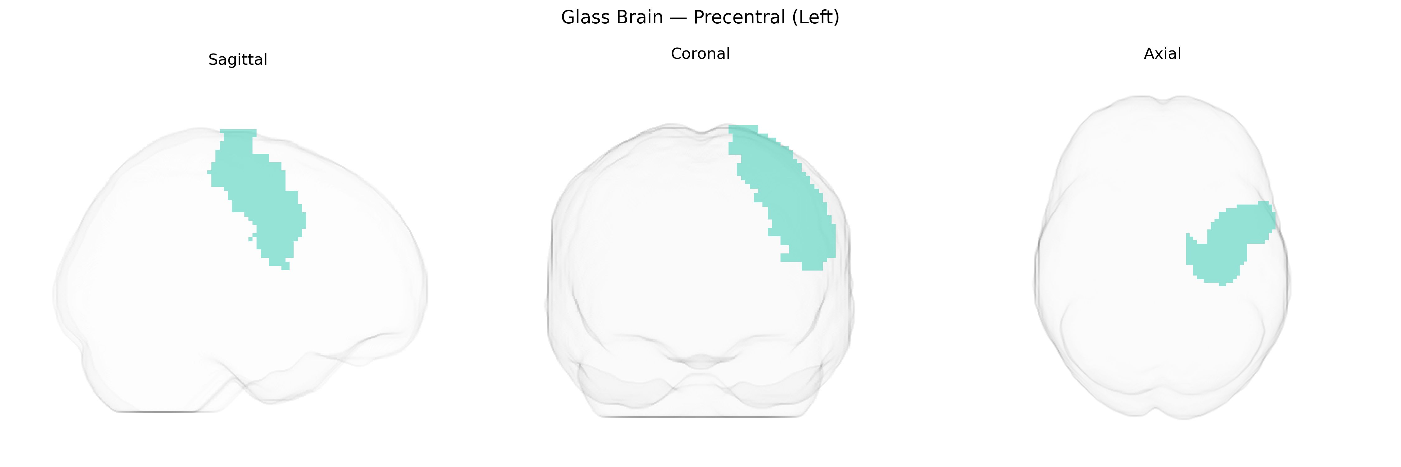 Triplanar Ghost Brain