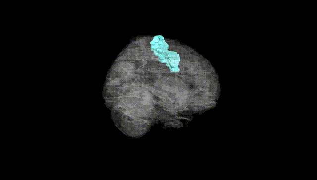 Full Brain Black