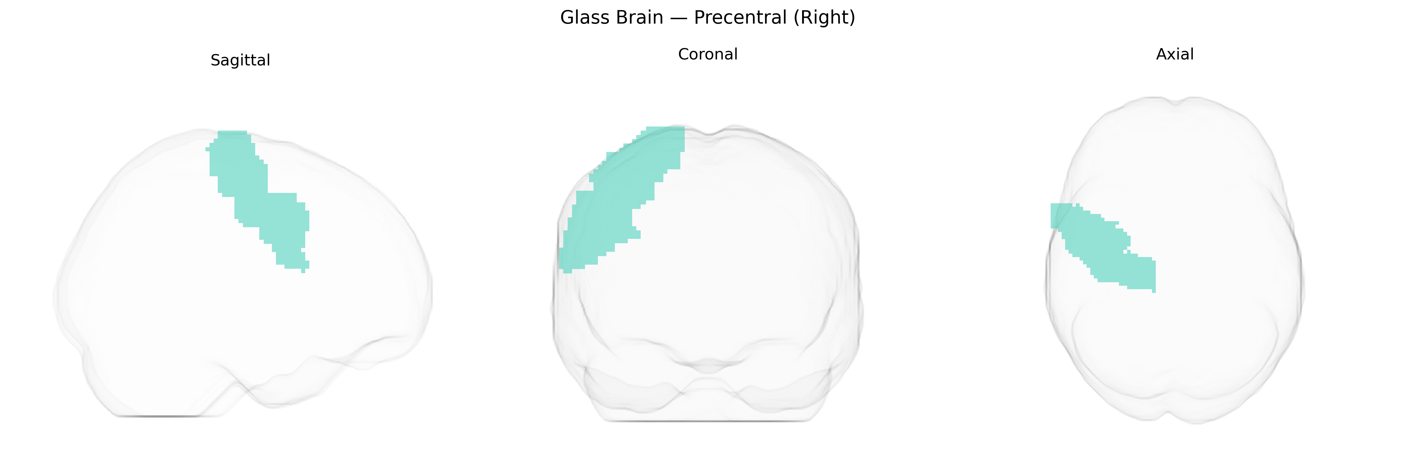 Triplanar Ghost Brain