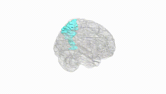 Full Brain White