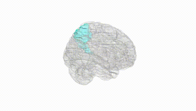 Full Brain White