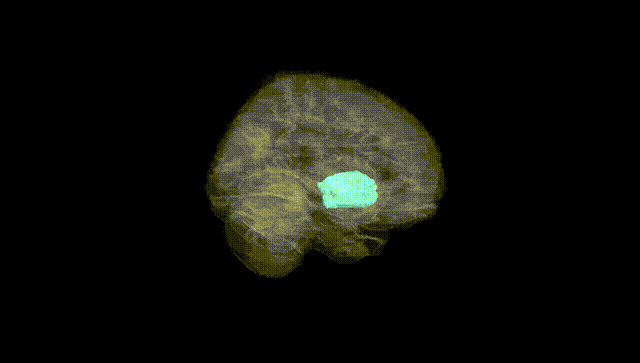 Full Brain Black