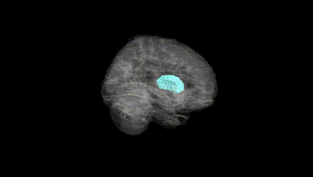 Full Brain Black