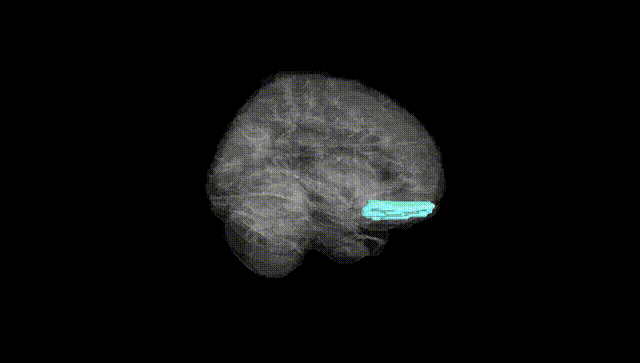 Full Brain Black