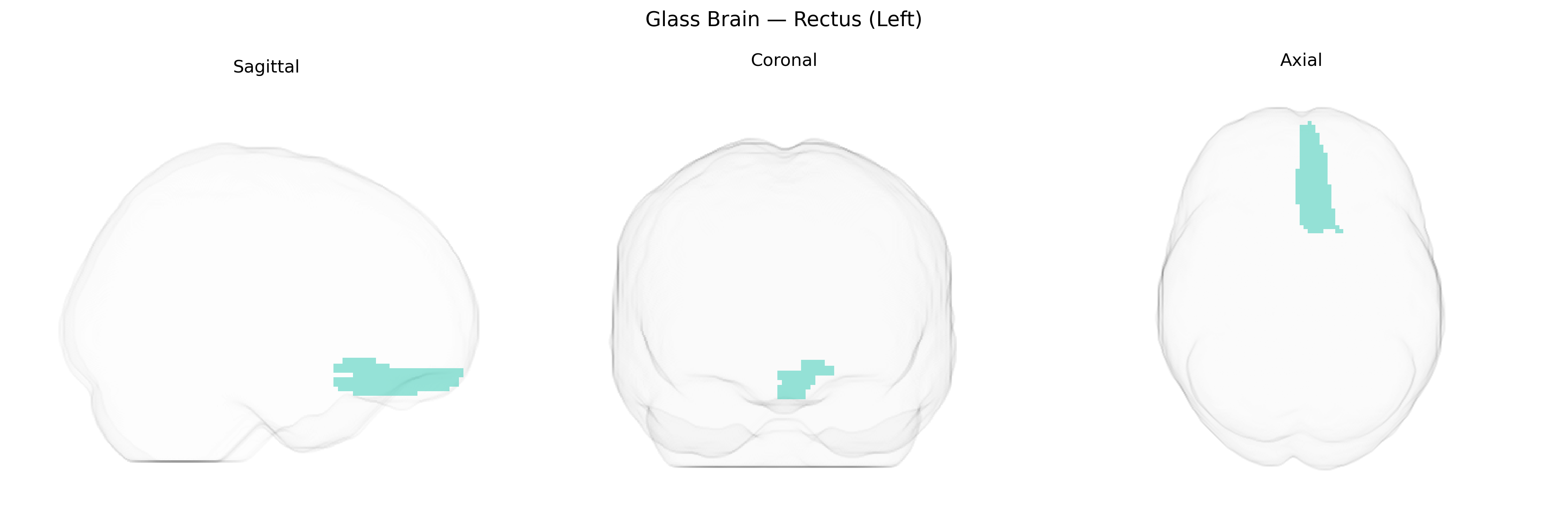 Triplanar Ghost Brain