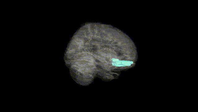 Full Brain Black