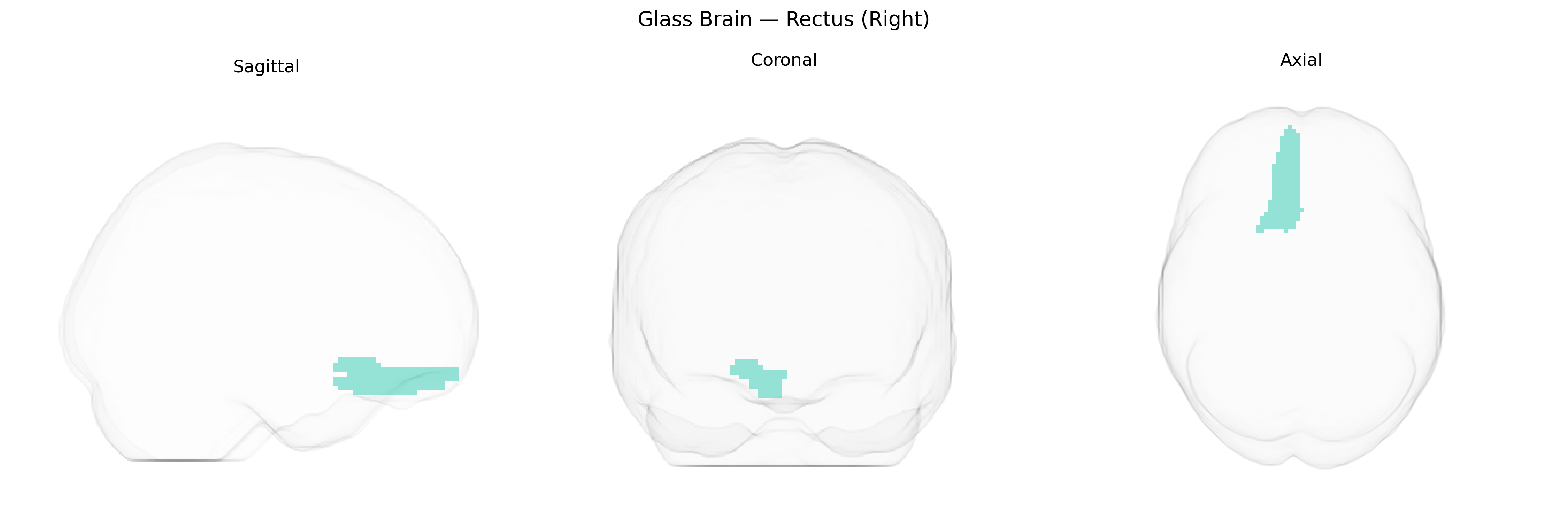 Triplanar Ghost Brain
