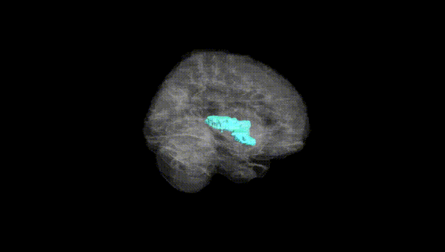 Full Brain Black